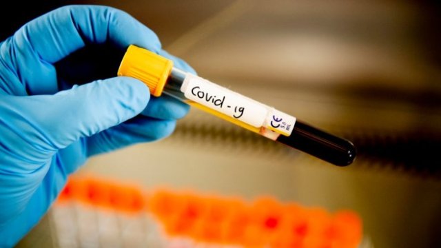 Какво се случва, след като оздравеем от Covid-19?