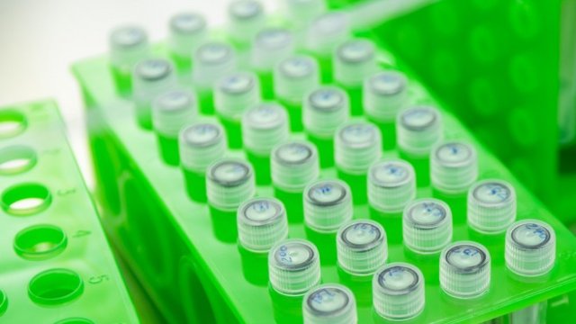 <p>
	<em>Снимка:&nbsp;Bloomberg Creative Photos/Bloomberg</em></p>
