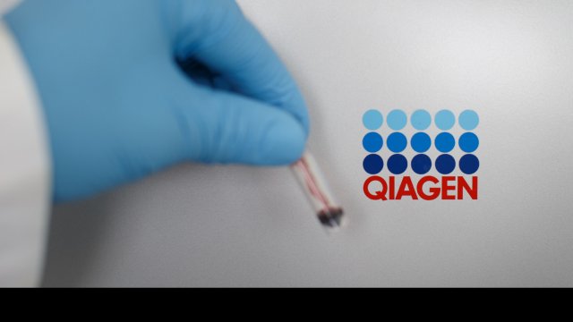 Снимка: Jasper Juinen/Bloomberg