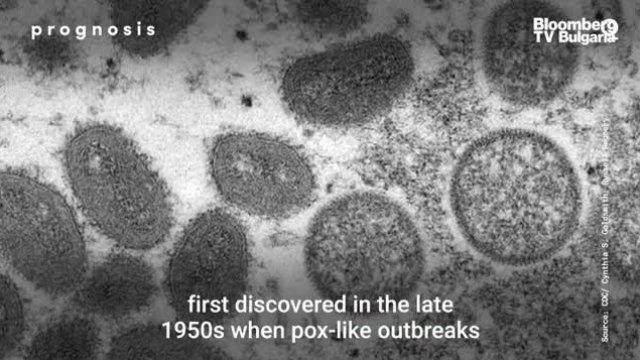 Какво трябва да знаем за маймунската шарка