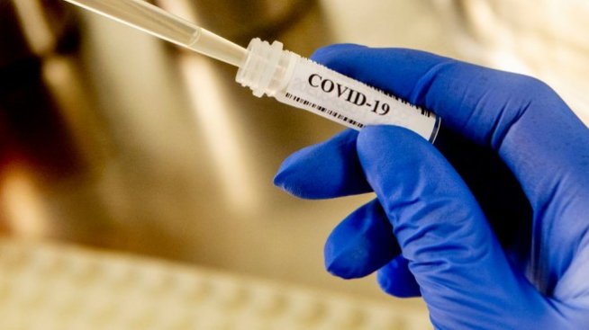 196 нови случая на коронавирус при 2003 теста