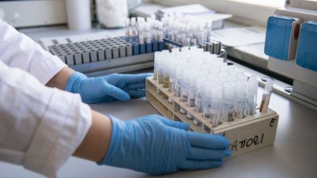 Болниците у нас ще удържат на втора вълна на коронавирус, твърди лекар