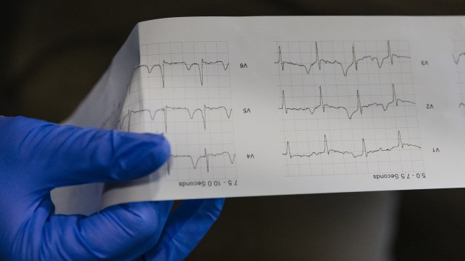 Медицинският жаргон обърква пациентите
