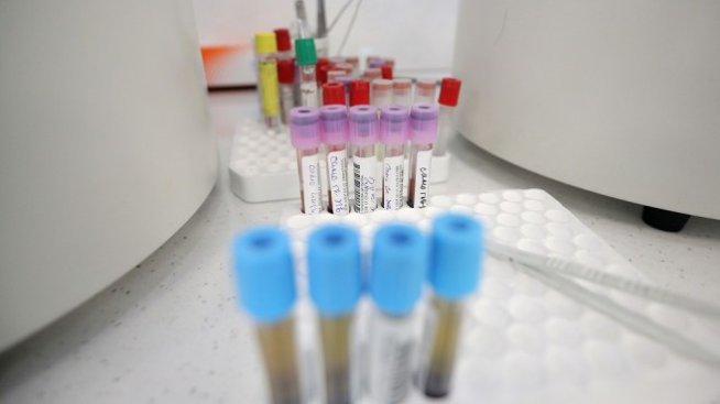 Проф. Момеков: Ефикасното действие на хлорохин е все още противоречиво