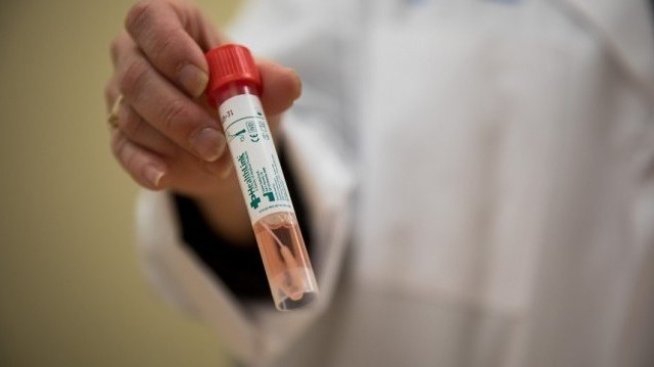 Проф. Константинов: Очаквам пикa на епидемията в следващите 20 дни