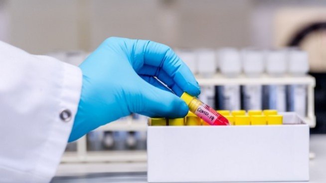 Имунолог: БЦЖ не предпазва от Covid-19, чакаме лекарство