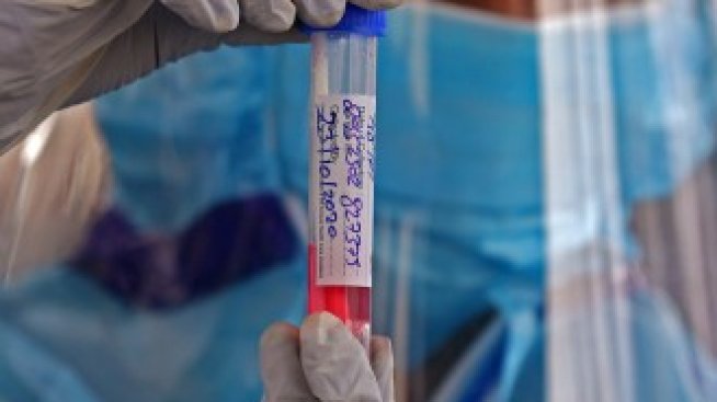 COVID-тестовете - основните въпроси и отговори