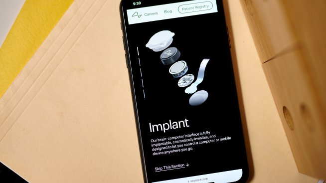 Има проблеми с устройството на Neuralink, имплантирано в човек