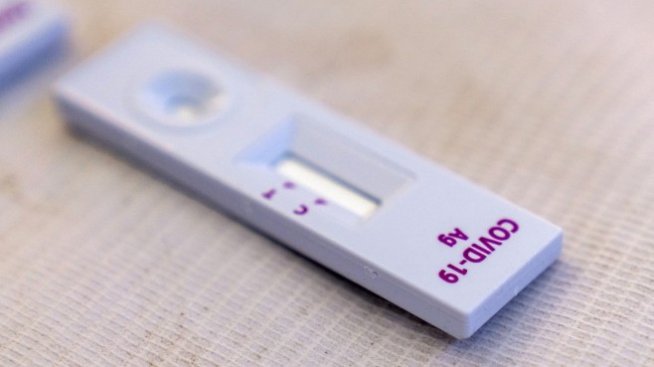 По какви критерии ще се назначава PCR тест?