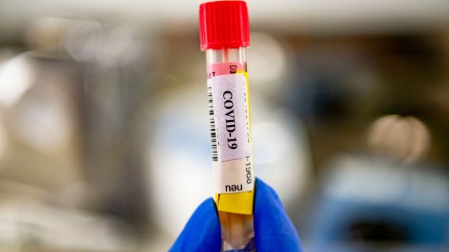 Вероятно е да няма други заразени от пациента с "Делта" варианта на COVID-19