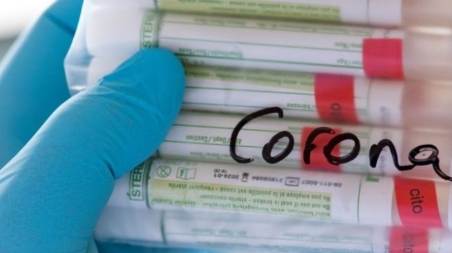 Започват доставки на хлорохин в цялата страна