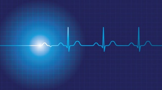 Точното време за рестарт на бизнеса