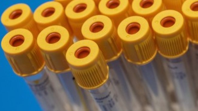 Блокадите са предотвратили смъртта от коронавирус на над 3 млн. души в Европа