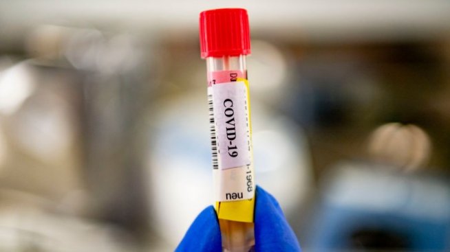 Проф. Витанов: Един на всеки 100 души у нас в момента е с COVID-19