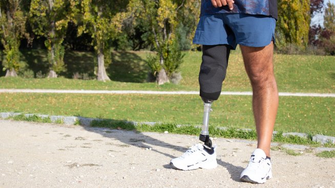 Войната превърна Русия в лидер в протезирането